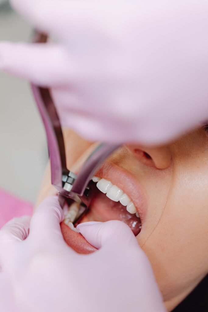 Patient undergoing a tooth extraction at a dental clinic