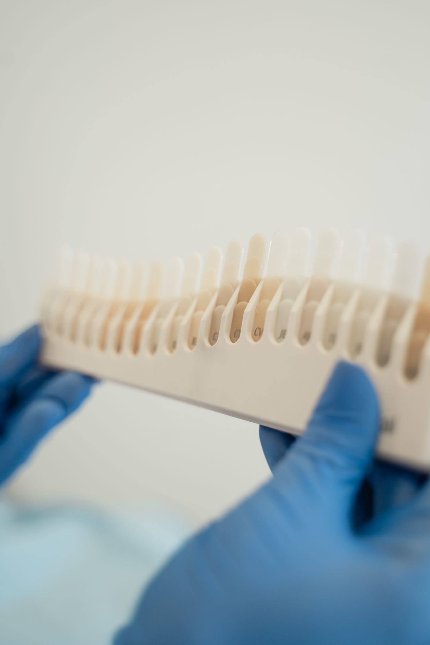 Tooth shade guide used to match crowns and veneers after whitening in Aurora