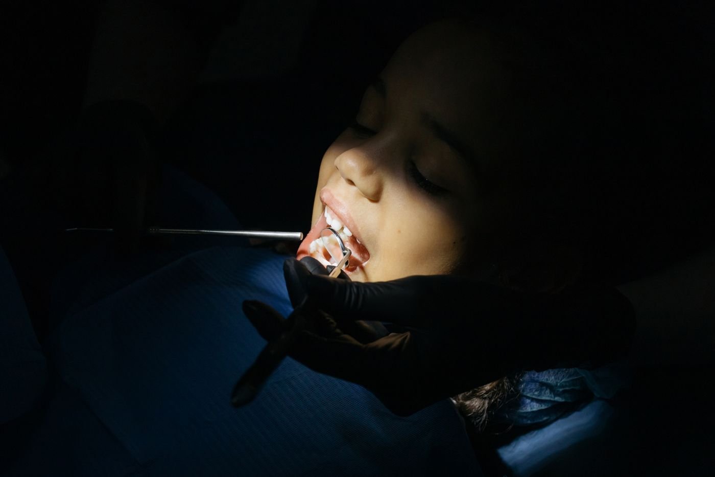 Young girl having a dental checkup for cavities in her baby teeth in Aurora