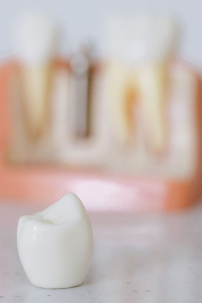 How Long Does a Dental Crown Procedure Take