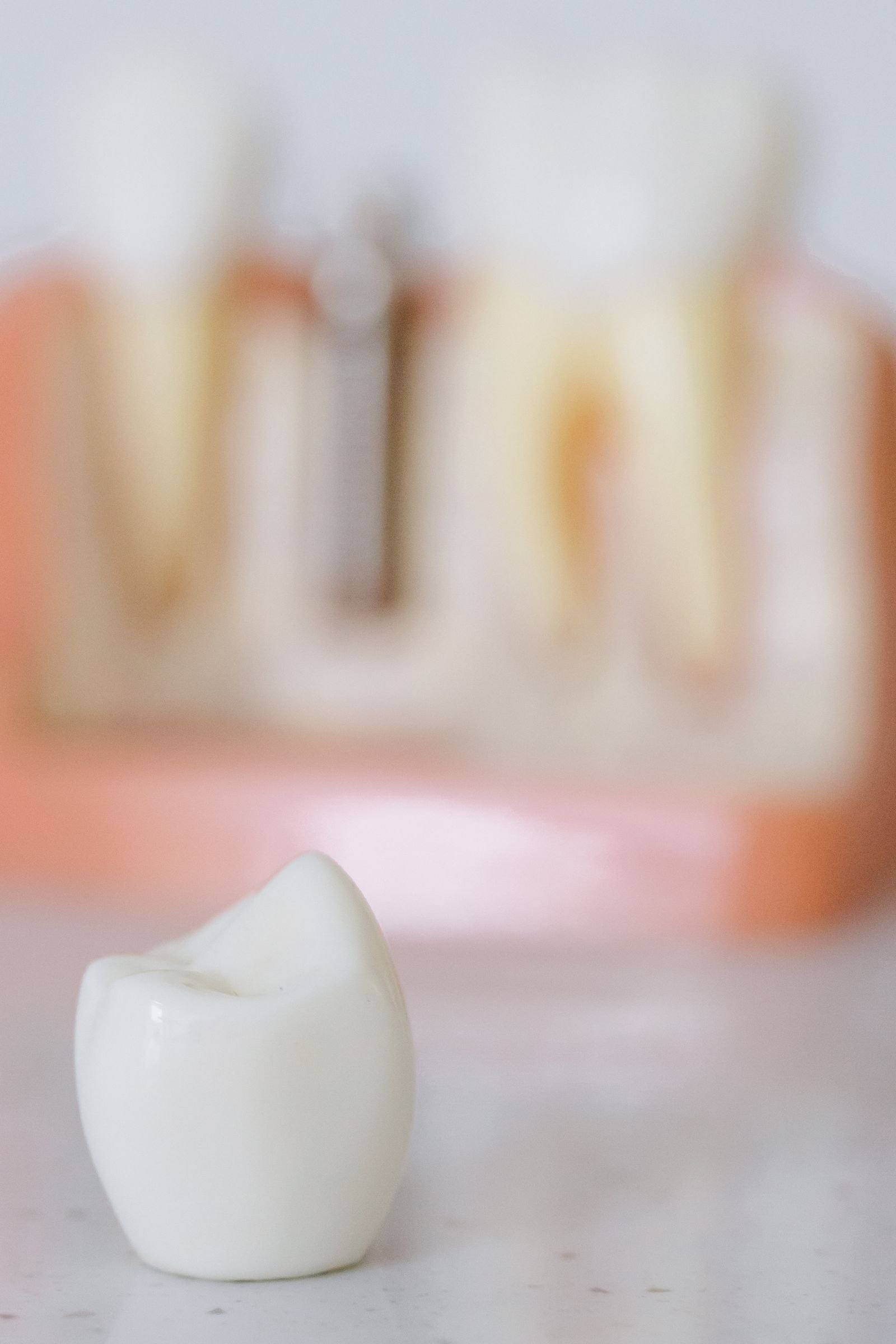 How Long Does a Dental Crown Procedure Take