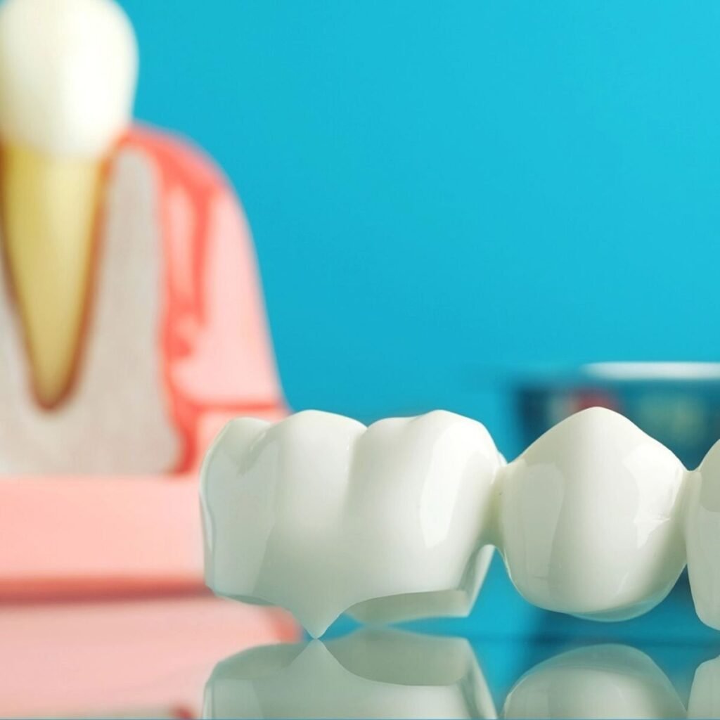 Close-up of a dental crown restoration