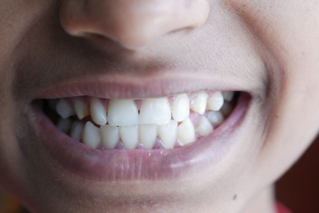 Close-up of teeth showing natural shade differences, including one darker tooth