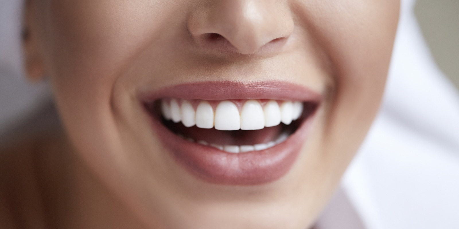 white teeth by dana dental