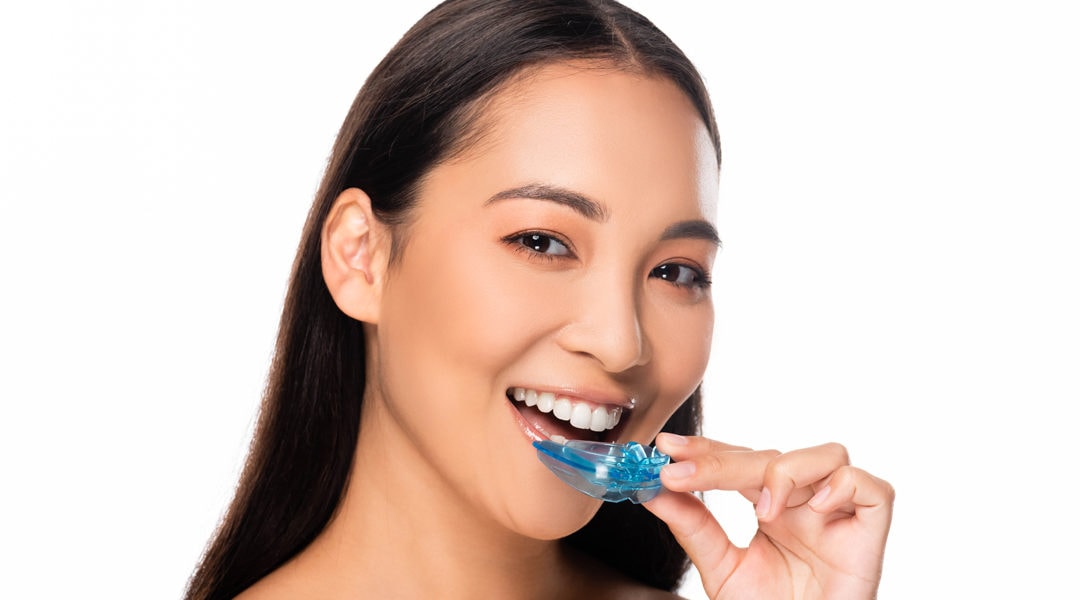 3 Signs Your Mouthguards In Aurora Are A Great Fit